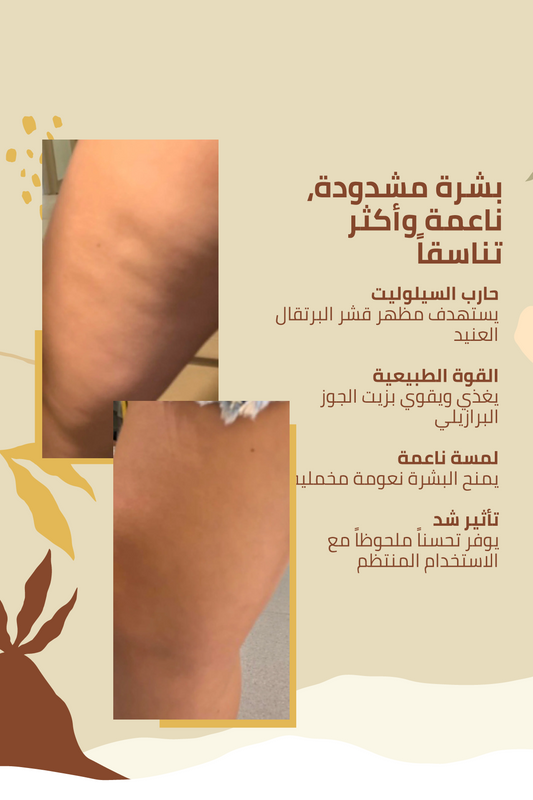 حماية مثالية ضد السيلوليت – 100 مل