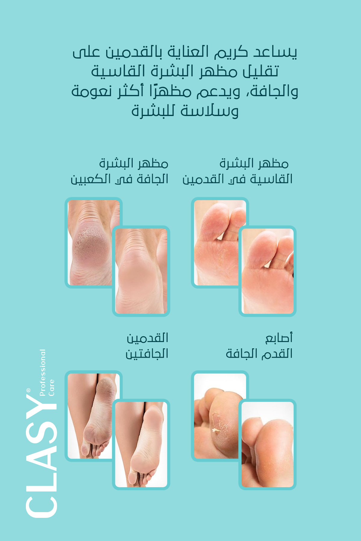كريم العناية المثالي لتشققات الكعبين والقدمين – **100 مل**