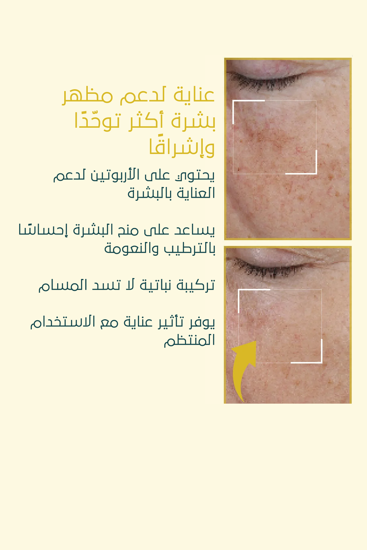 كريم تفتيح التصبغات – FACEUPSKIN® Spot Cream ‏40 مل