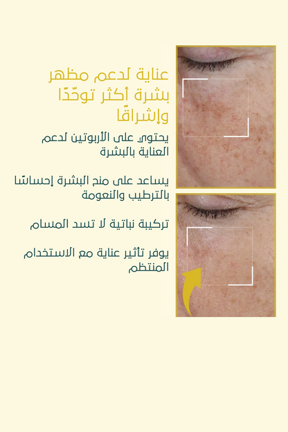 كريم تفتيح التصبغات – FACEUPSKIN® Spot Cream ‏40 مل