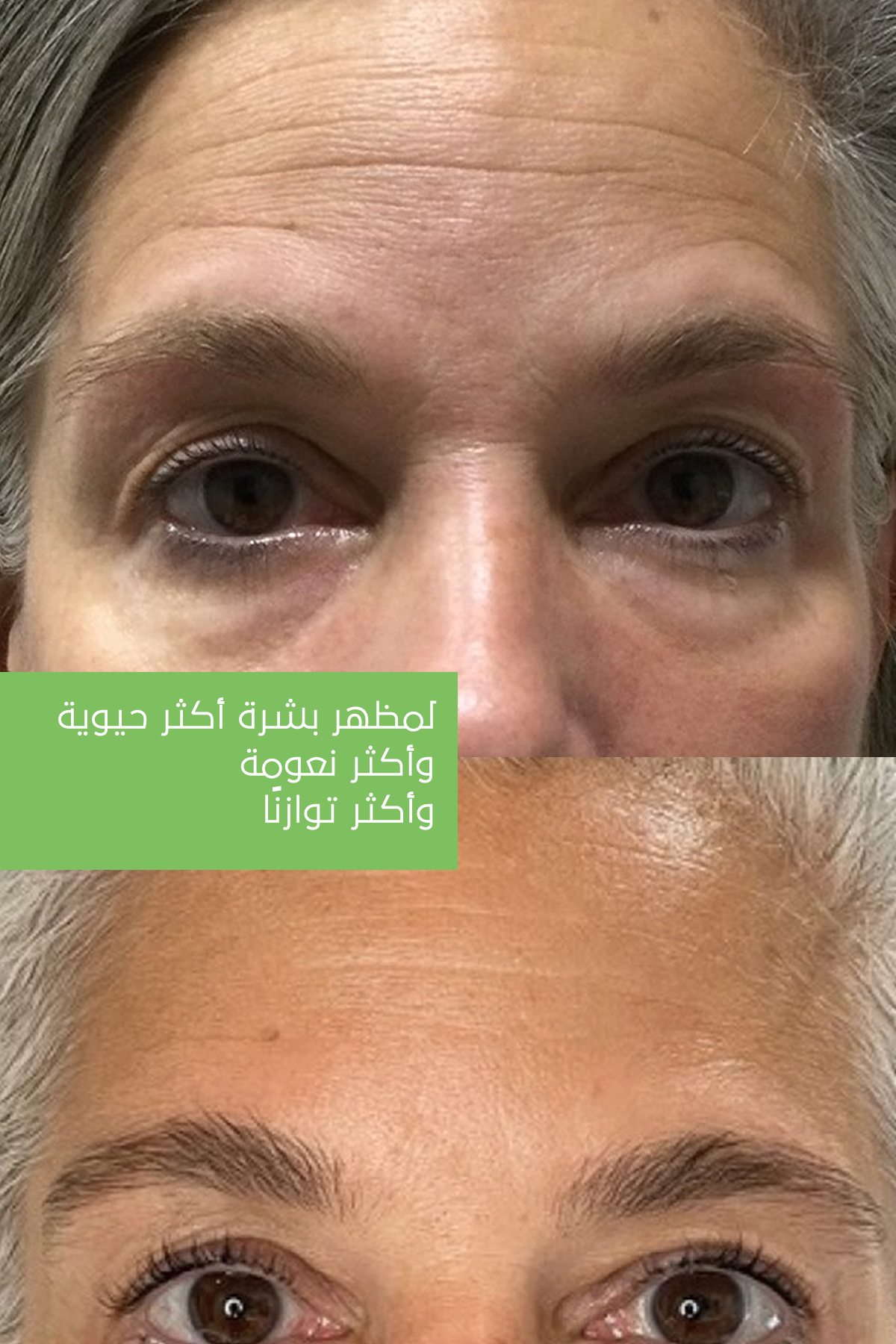 ماسك جل الألوفيرا – جل ماسك مُجدِّد – 20 ساشيه