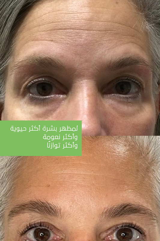 ماسك جل الألوفيرا – جل ماسك مُجدِّد – 20 ساشيه