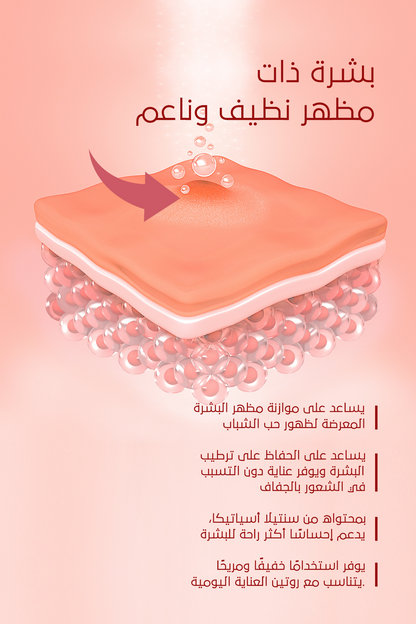 تأثير مثالي لحبّ الشباب والبثور – FACEUPSKIN® Acne Cream ‏40 مل