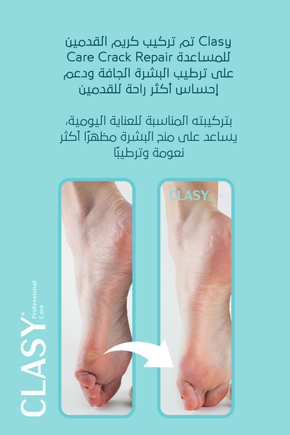 كريم العناية المثالي لتشققات الكعبين والقدمين – **100 مل**