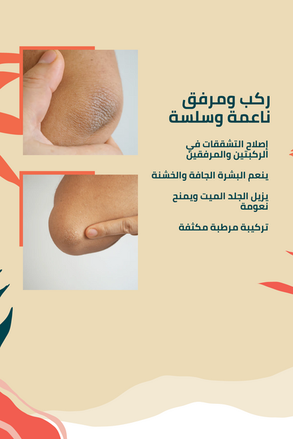 لتشقّقات الركبة والمرفقين –100 مل
