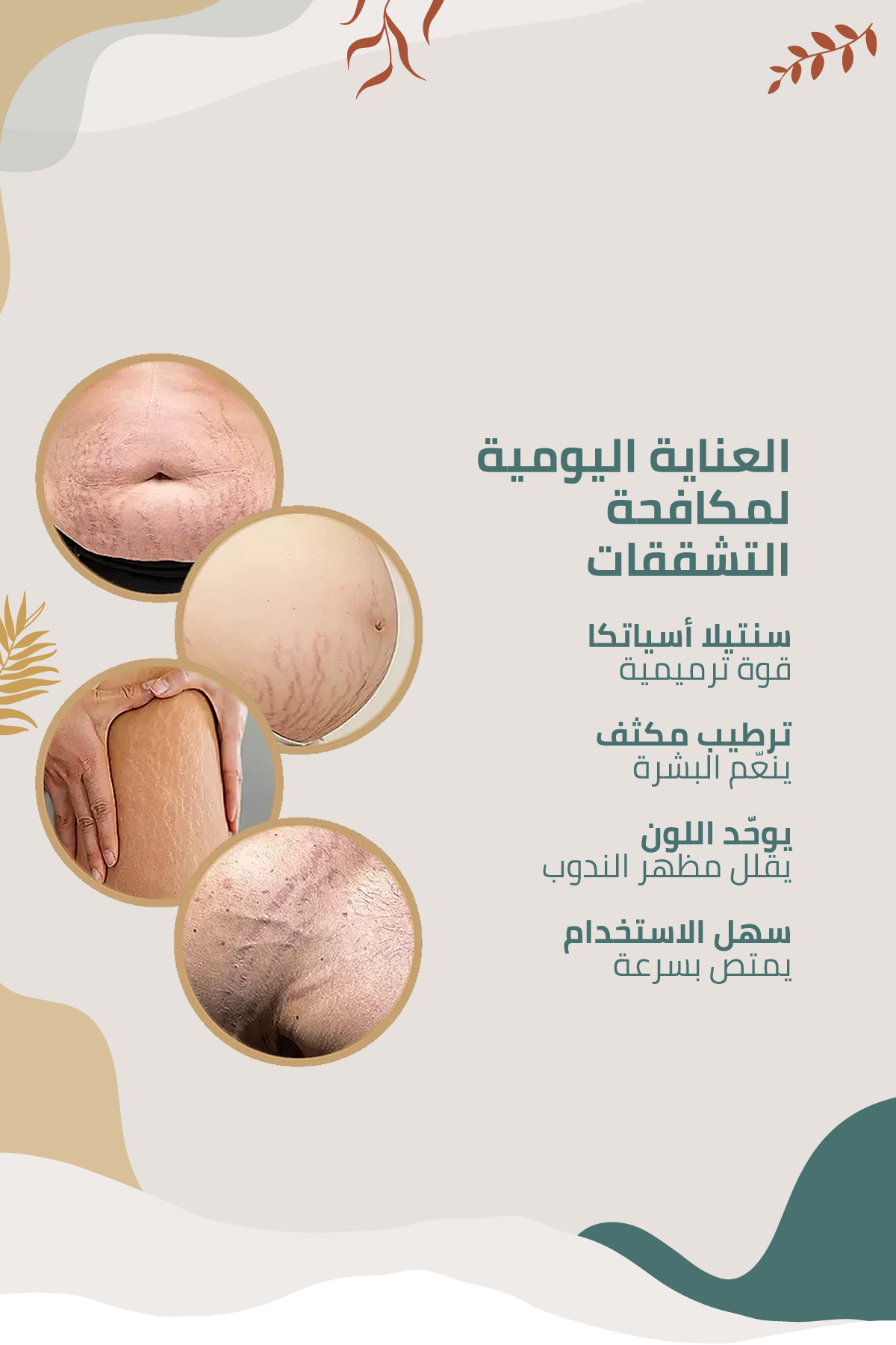 كريم متطور للعناية بمظهر علامات التمدد والندبات مع خلاصة نبات السنتيلا الآسيوية – 100 مل