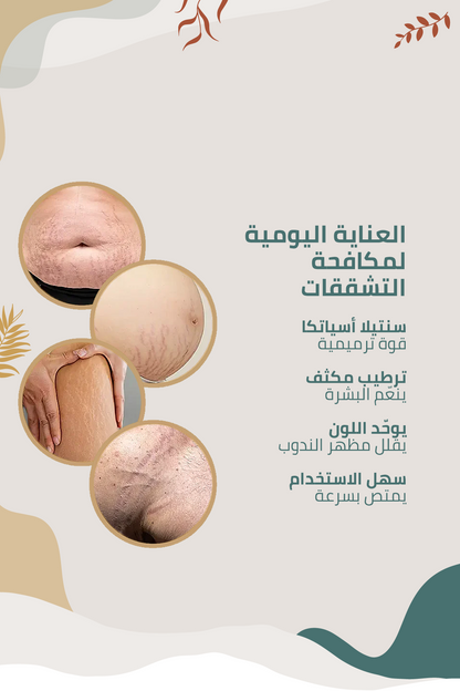كريم متطور للعناية بمظهر علامات التمدد والندبات مع خلاصة نبات السنتيلا الآسيوية – 100 مل