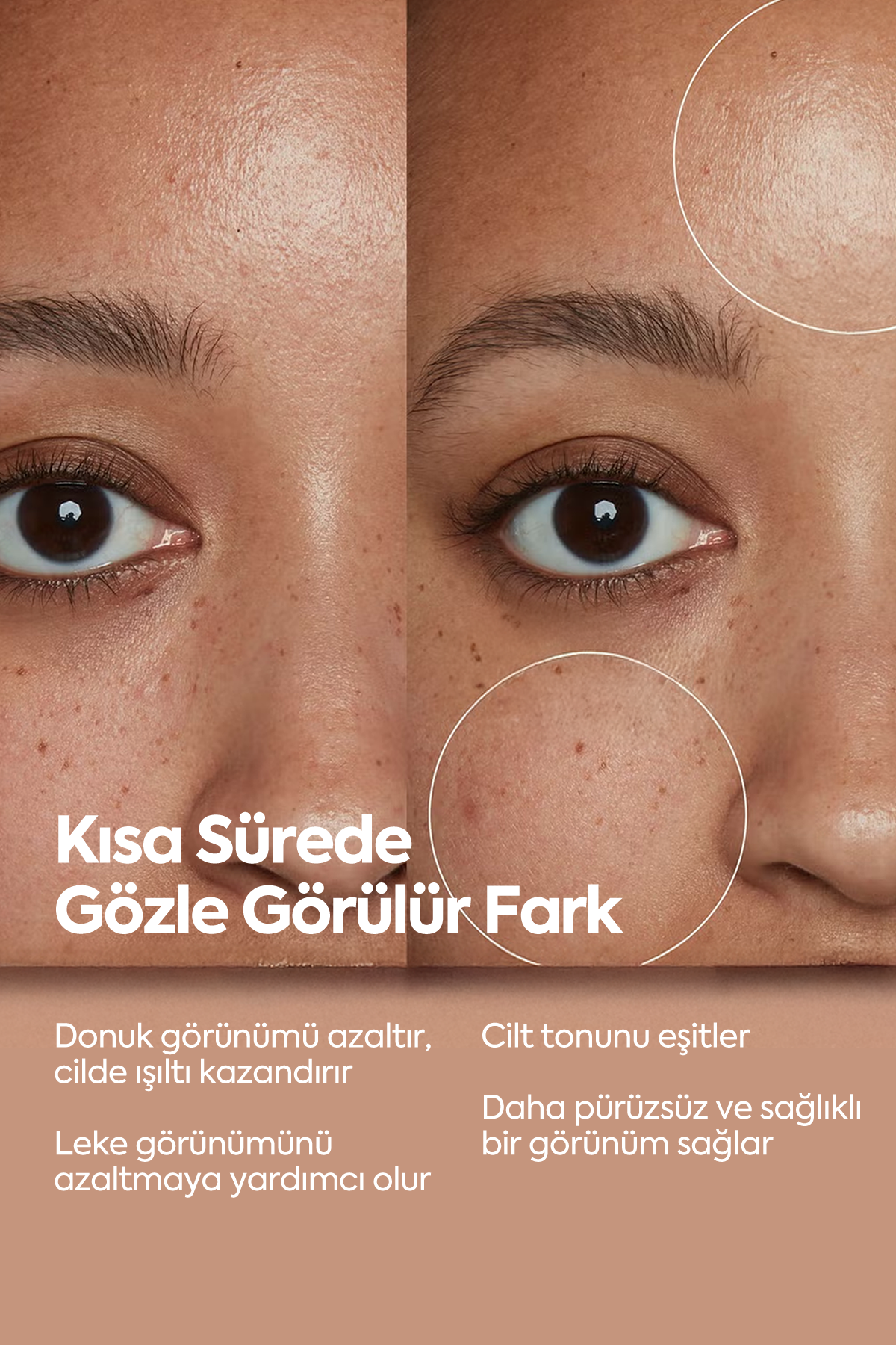 Aydınlatıcı Ve Leke Görünümü Azaltıcı - مصل تفتيح 50 مل