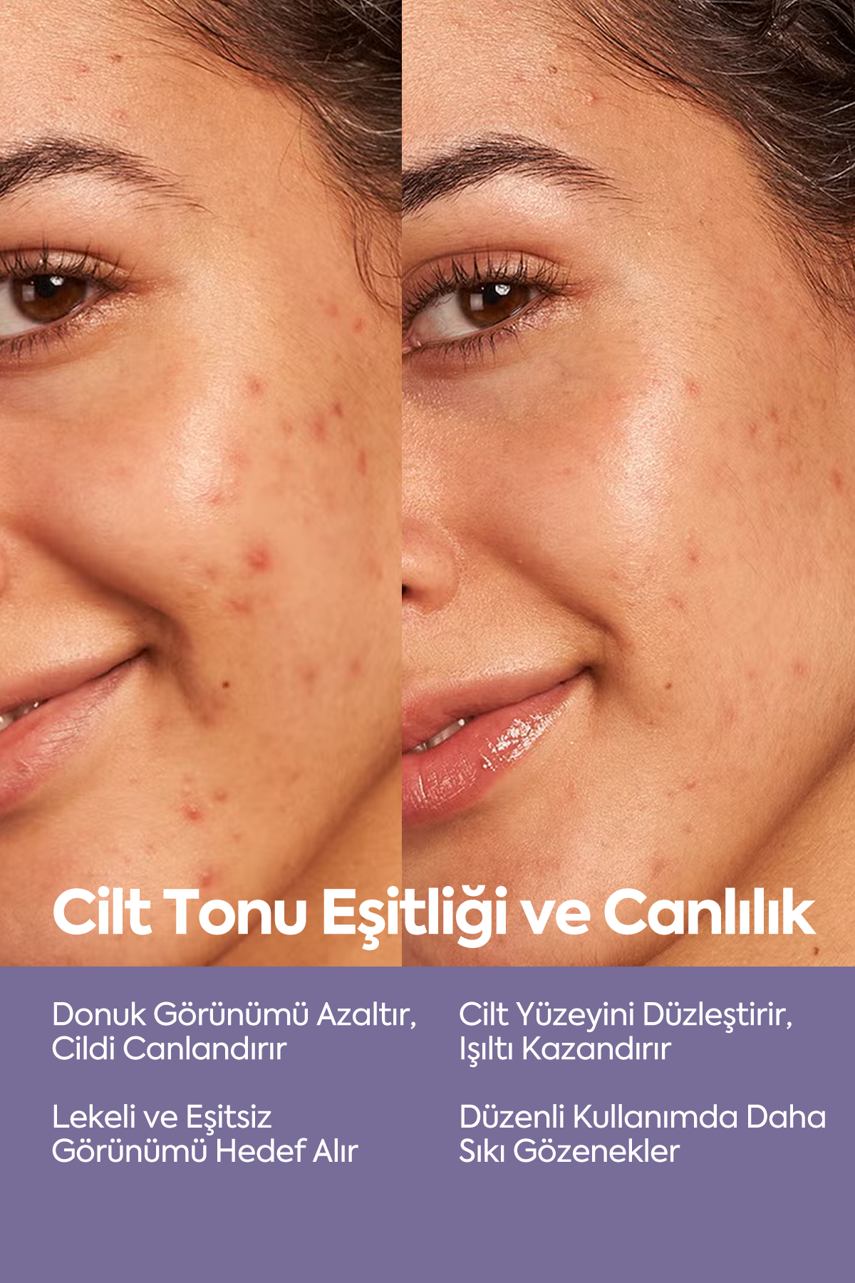 Cilt Tonu Eşitleyici Peeling - مصل التقشير AHA-BHA 50 مل