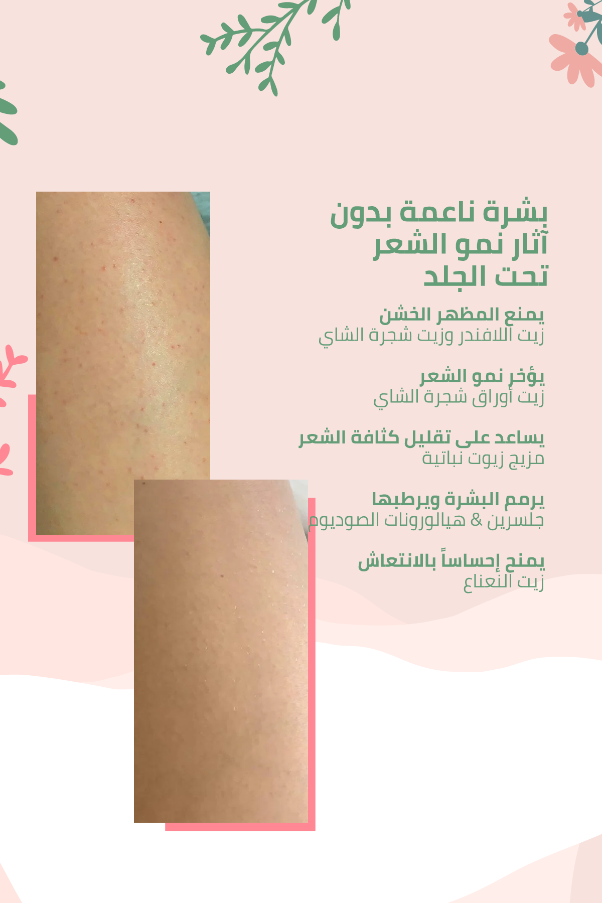 مخفِّف نموّ الشعر بعد إزالة الشعر – Bye-Bye Hairs 100 مل