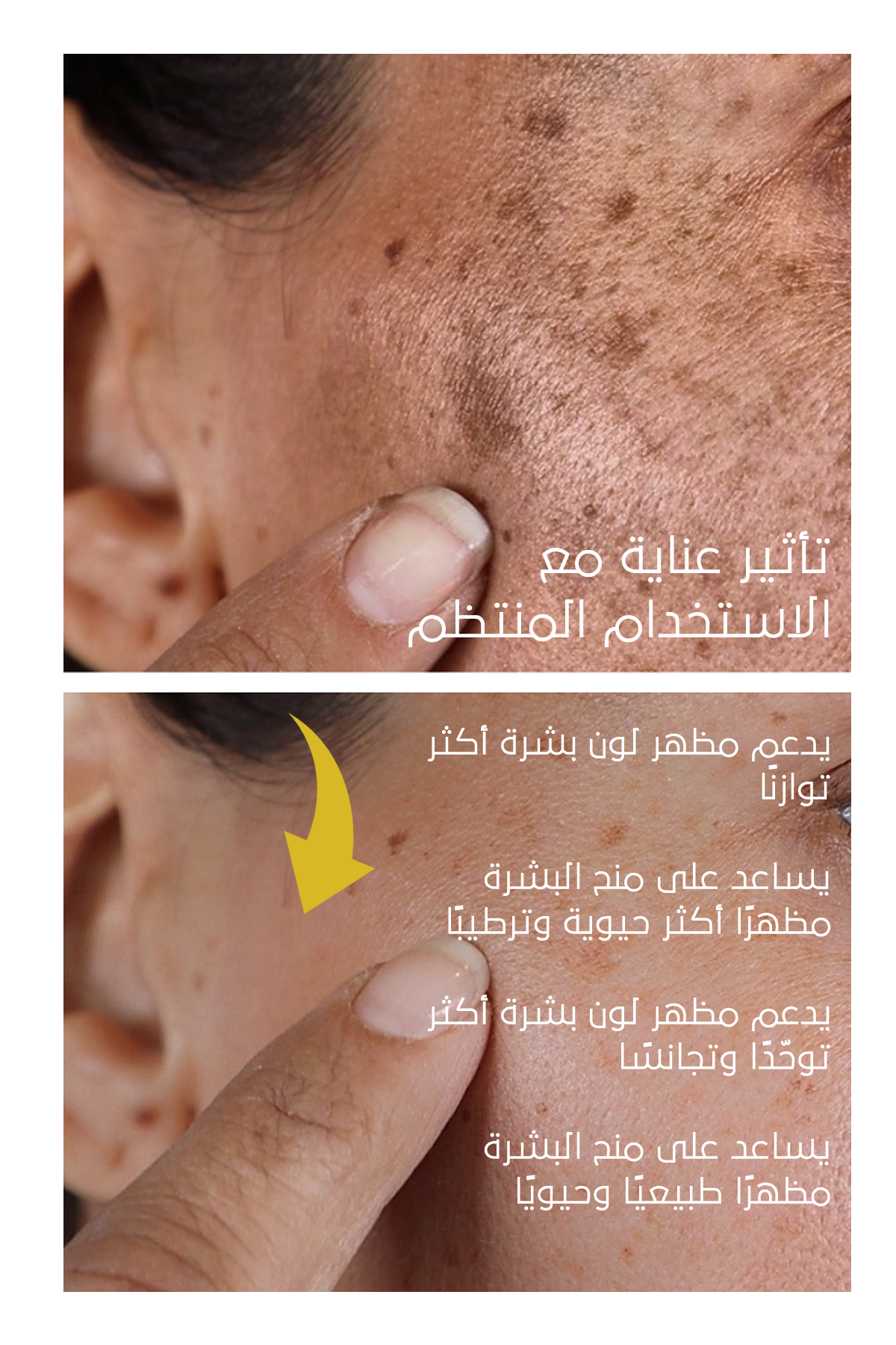 كريم تفتيح التصبغات – FACEUPSKIN® Spot Cream ‏40 مل