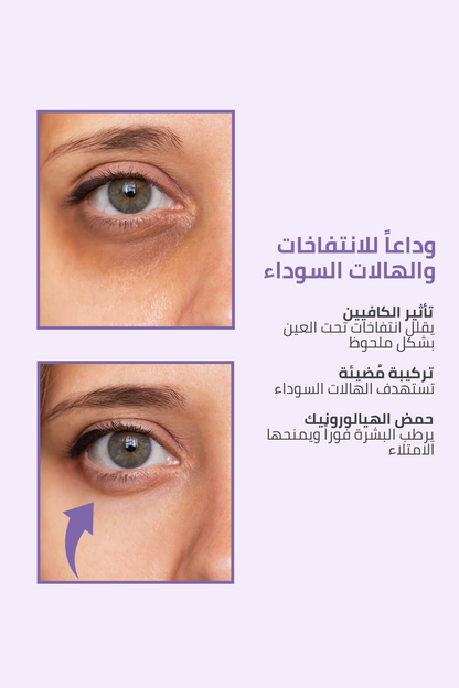 لانتفاخات وهالات تحت العين – FACEUPSKIN® Under Eye Cream 40 مل