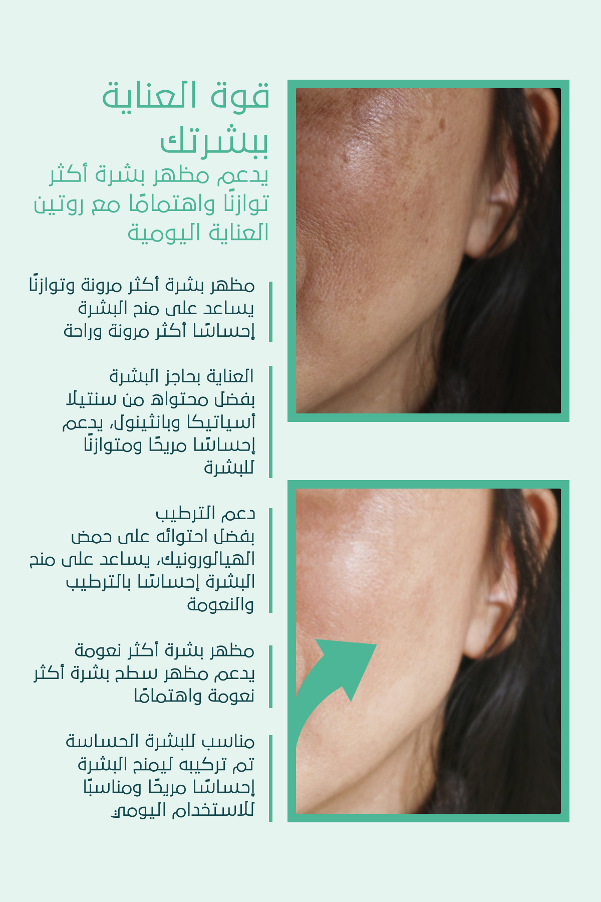 مُرمِّم البشرة المثالي – **FACEUPSKIN® Restorative Cream 40 مل**