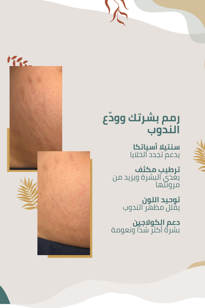 كريم متطور للعناية بمظهر علامات التمدد والندبات مع خلاصة نبات السنتيلا الآسيوية – 100 مل