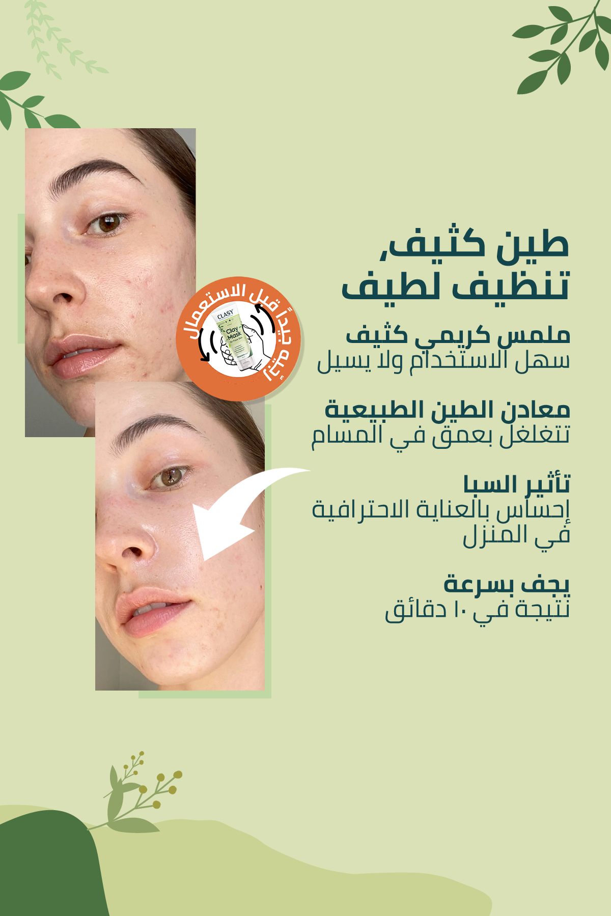 ماسك الطين المضاد للجلد الميت – 100 مل