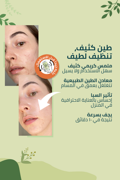 ماسك الطين المضاد للجلد الميت – 100 مل