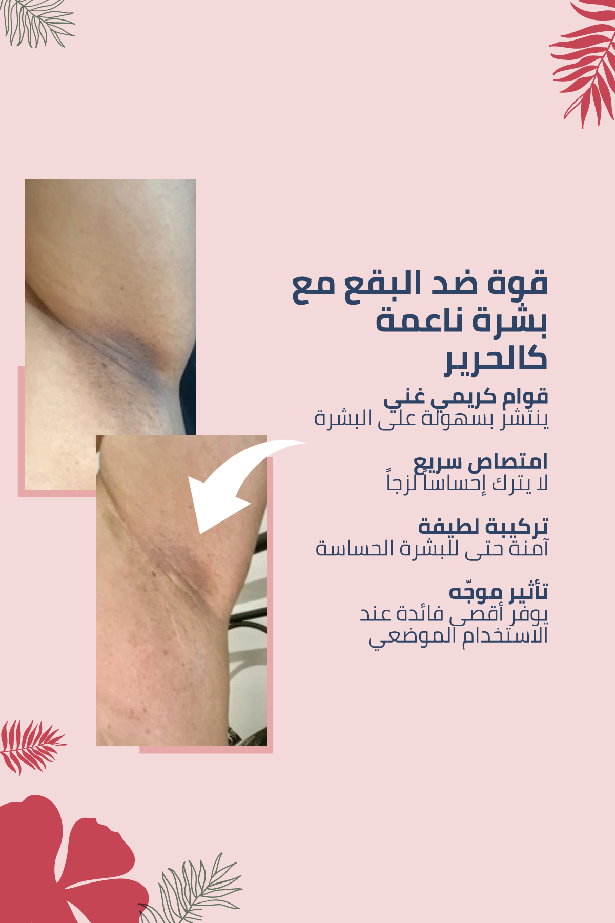 تركيبة ألبانية مضادّة للبقع ومُوحِّدة لون البشرة – 100 مل
