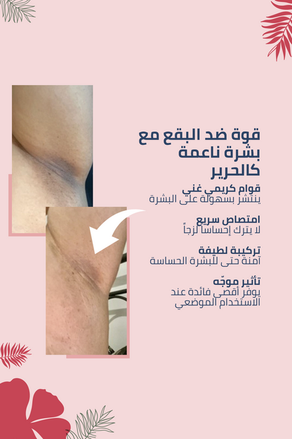 تركيبة ألبانية مضادّة للبقع ومُوحِّدة لون البشرة – 100 مل
