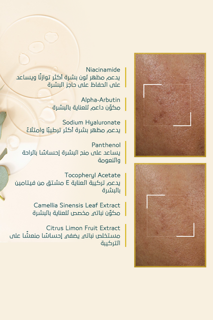 كريم تفتيح التصبغات – FACEUPSKIN® Spot Cream ‏40 مل