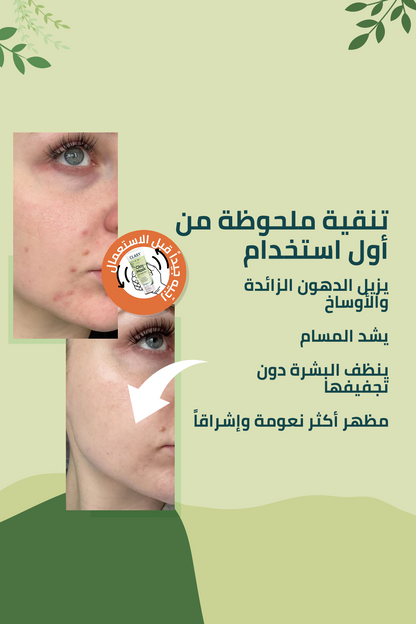 ماسك الطين المضاد للجلد الميت – 100 مل