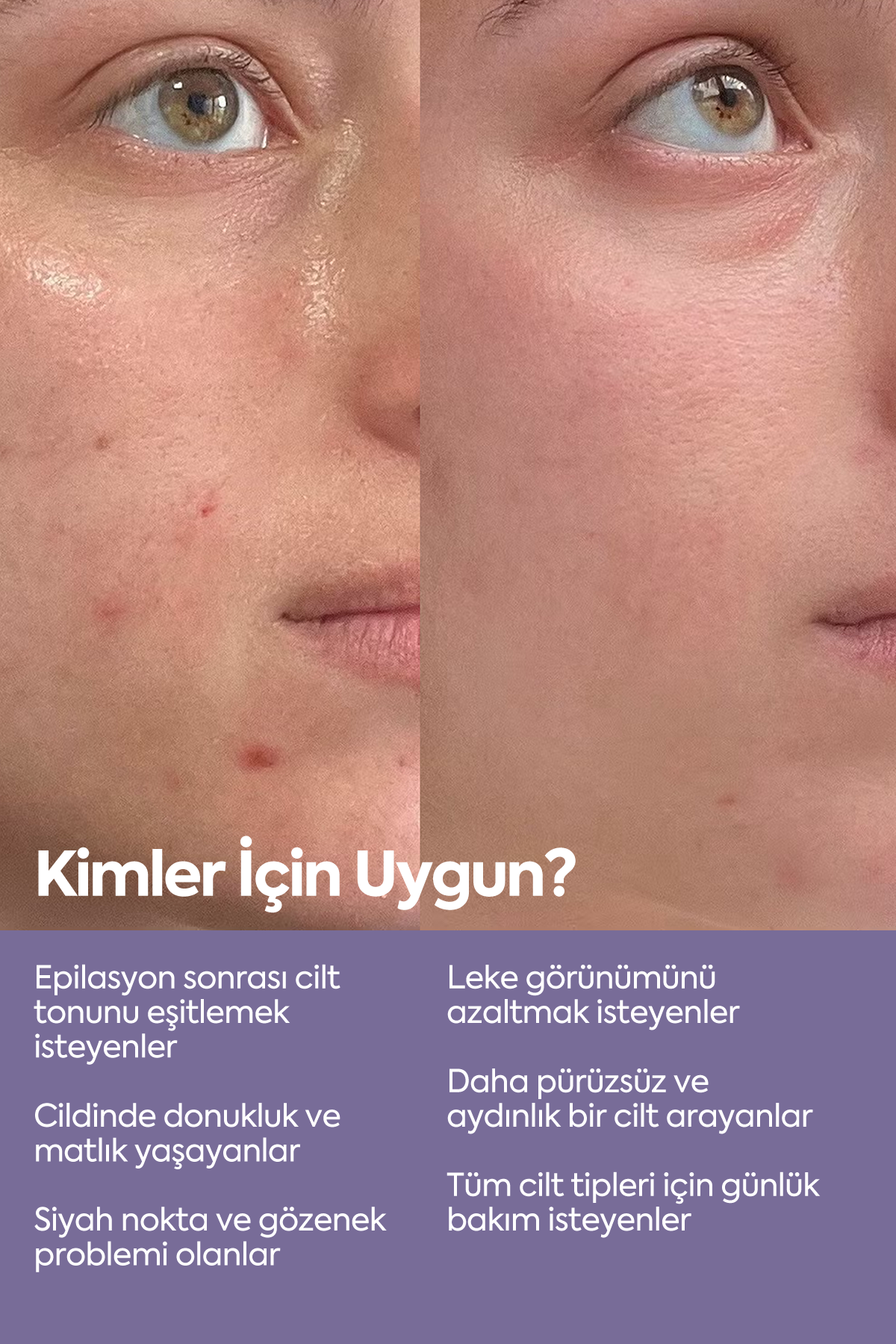 Cilt Tonu Eşitleyici Peeling - مصل التقشير AHA-BHA 50 مل