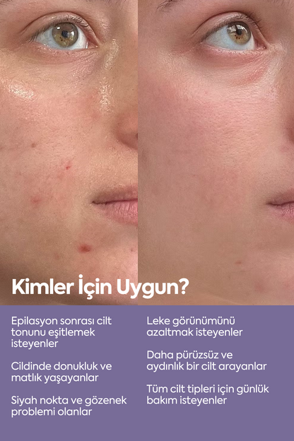 Cilt Tonu Eşitleyici Peeling - مصل التقشير AHA-BHA 50 مل