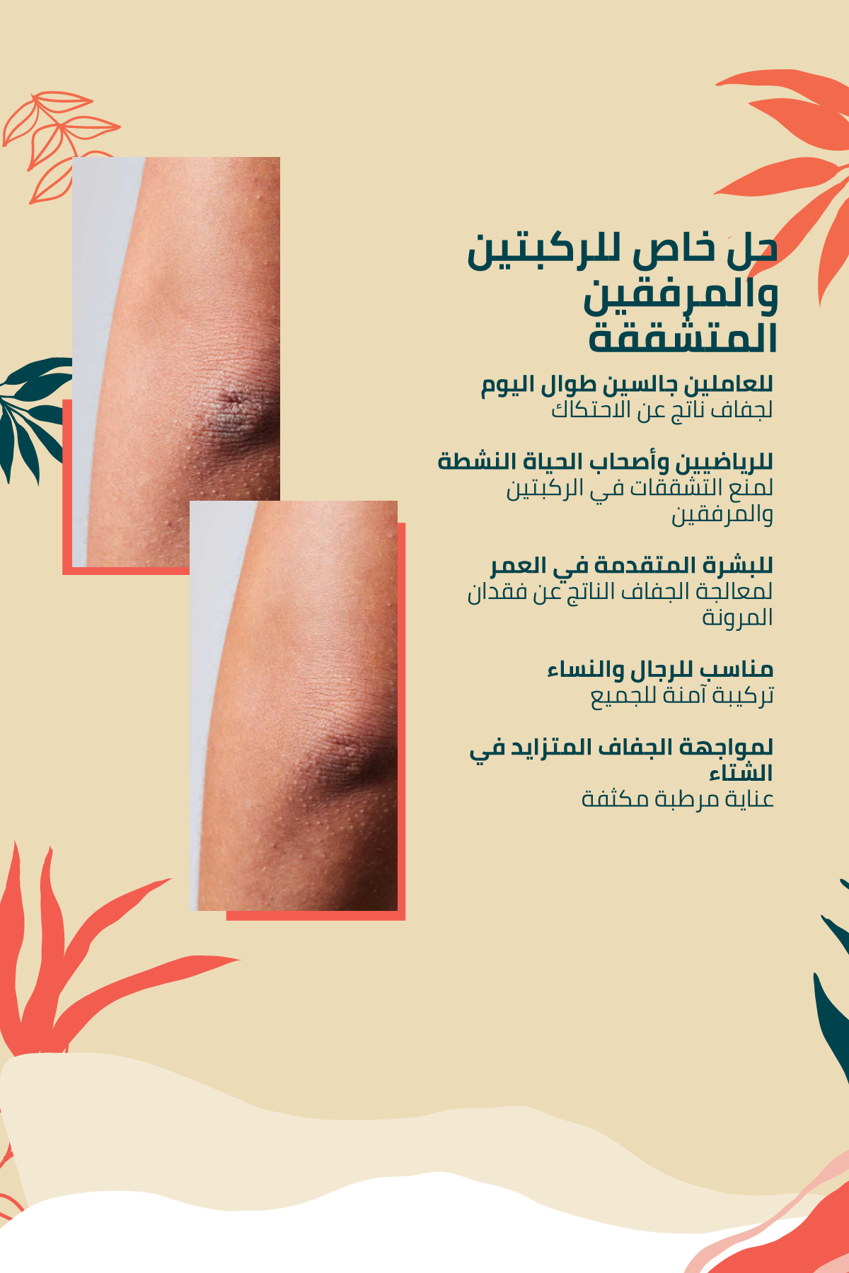 لتشقّقات الركبة والمرفقين –100 مل
