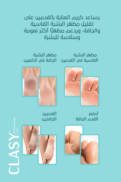 كريم العناية المثالي لتشققات الكعبين والقدمين – **100 مل**