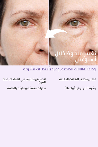لانتفاخات وهالات تحت العين – FACEUPSKIN® Under Eye Cream 40 مل