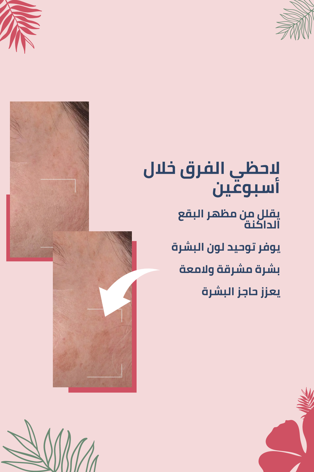 تركيبة ألبانية مضادّة للبقع ومُوحِّدة لون البشرة – 100 مل
