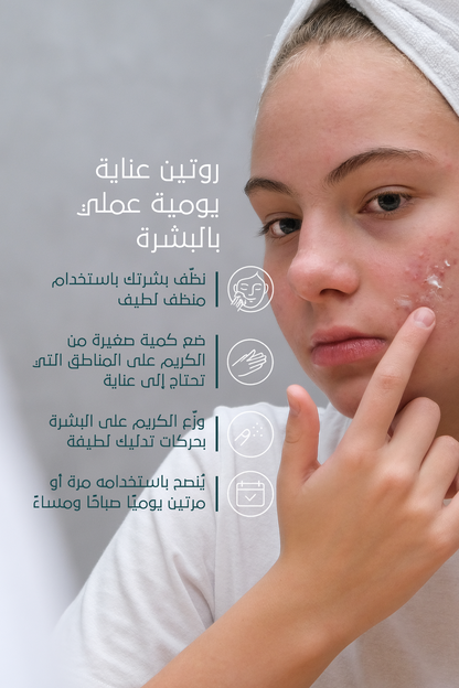 تأثير مثالي لحبّ الشباب والبثور – FACEUPSKIN® Acne Cream ‏40 مل
