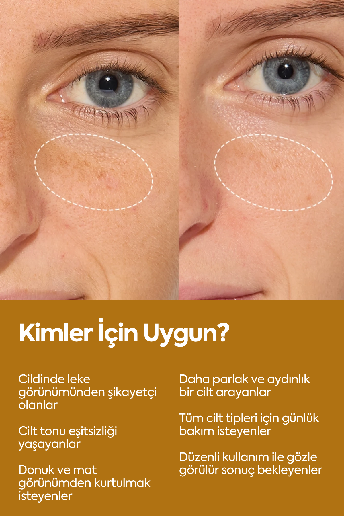 Aydınlatıcı Ve Leke Görünümü Azaltıcı - مصل تفتيح 50 مل