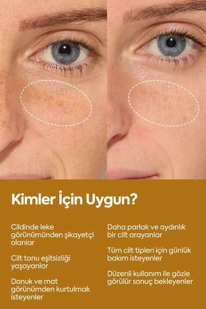 Aydınlatıcı Ve Leke Görünümü Azaltıcı - مصل تفتيح 50 مل