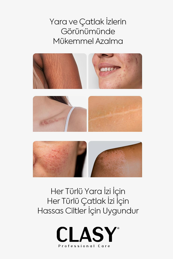 Çatlaklar ve İzler için Mükemmel Yenilenme - 100 ml