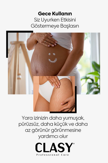 Çatlaklar ve İzler için Mükemmel Yenilenme - 100 ml