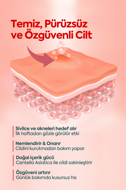 Akne ve Sivilceler için Mükemmel Etki - كريم حب الشباب FACEUPSKIN® 40 مل