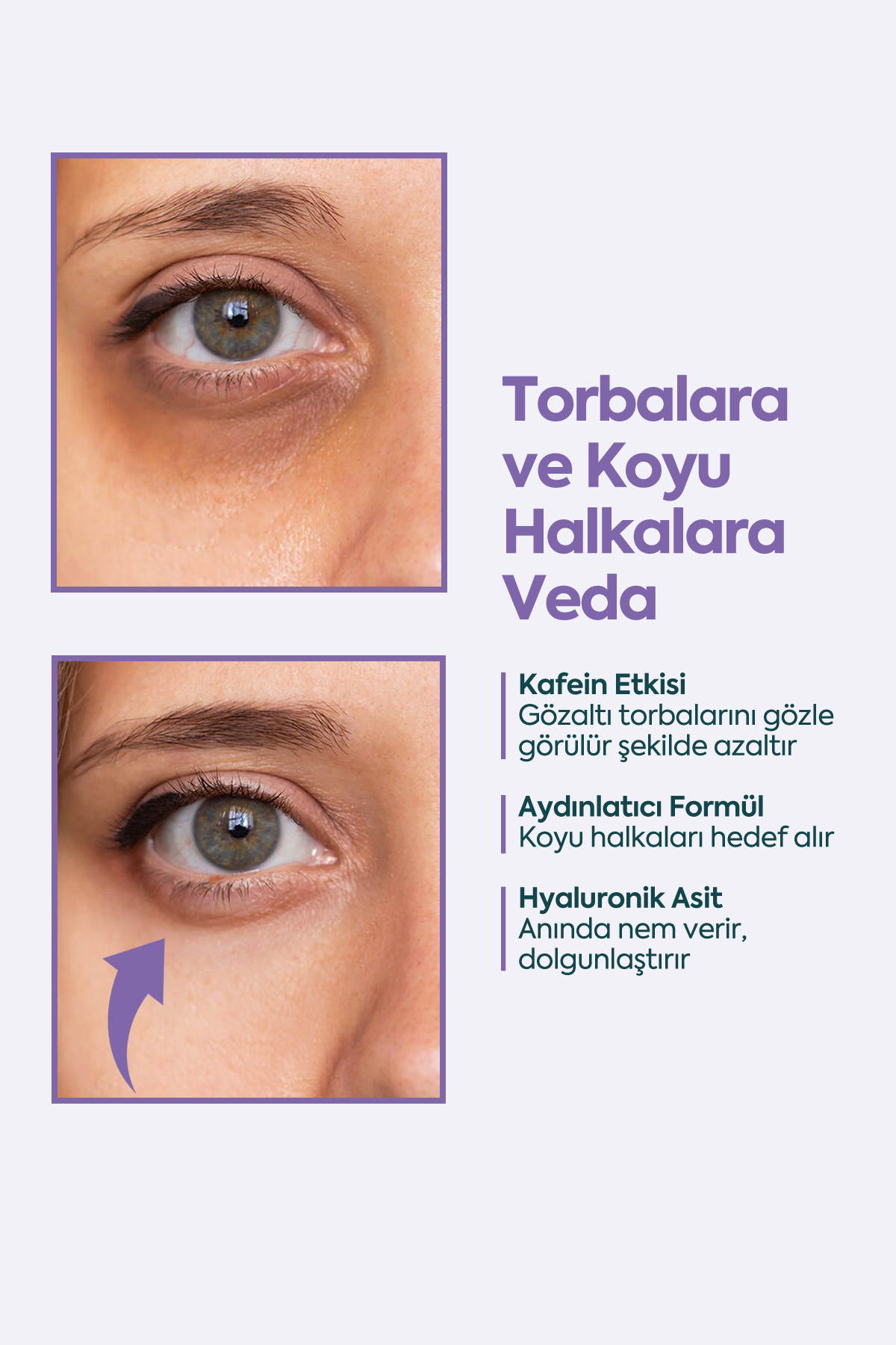 Gözaltı Torbaları ve Koyuluklar için - FACEUPSKIN® Under Eye Cream 40 ml