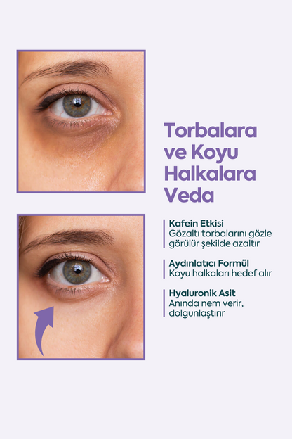 Gözaltı Torbaları ve Koyuluklar için - FACEUPSKIN® Under Eye Cream 40 ml