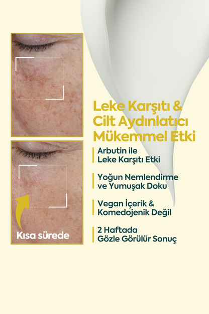 Aydınlatıcı Leke Kremi - FACEUPSKIN® كريم البقع 40 مل