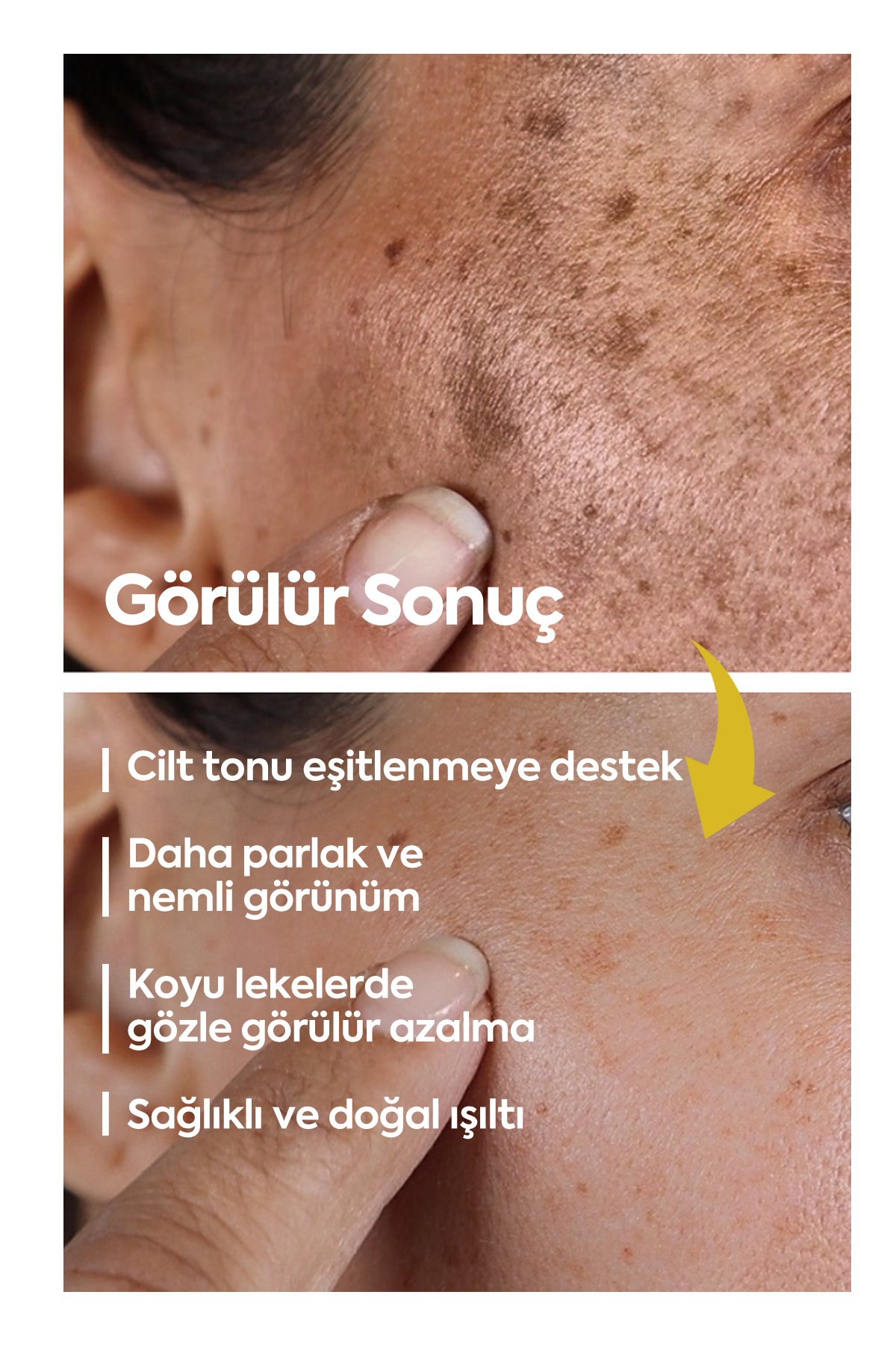 Aydınlatıcı Leke Kremi - FACEUPSKIN® كريم البقع 40 مل
