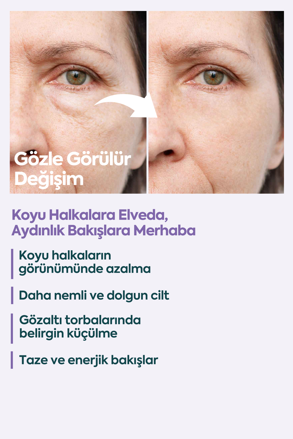 Gözaltı Torbaları ve Koyuluklar için - FACEUPSKIN® Under Eye Cream 40 ml