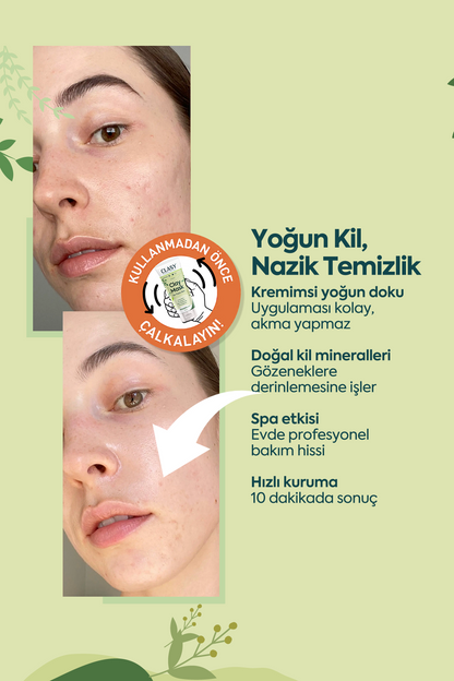 Ölü Deriye Karşı Kil Maskesi - 100 مل