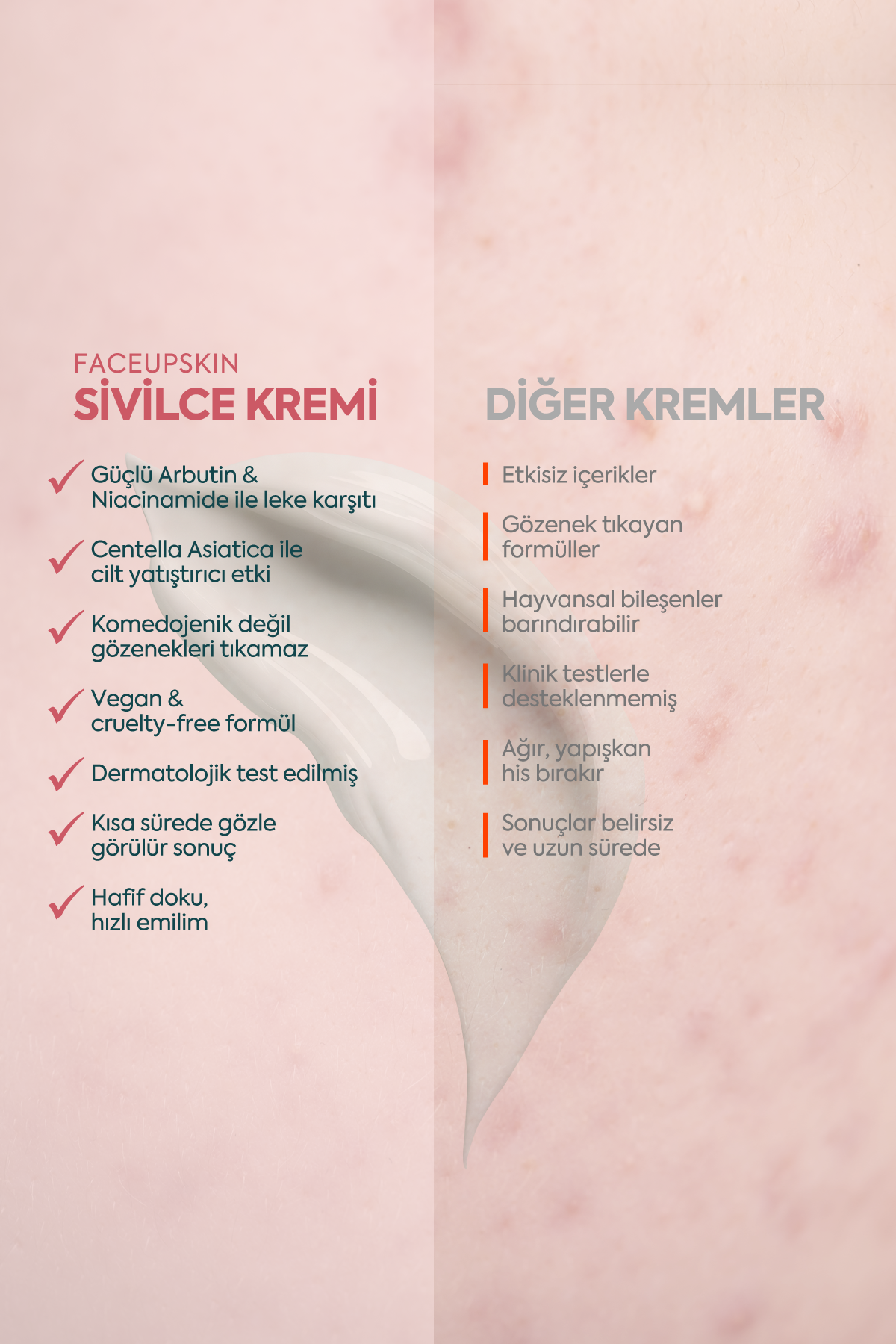 Akne ve Sivilceler için Mükemmel Etki - كريم حب الشباب FACEUPSKIN® 40 مل