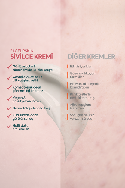 Akne ve Sivilceler için Mükemmel Etki - كريم حب الشباب FACEUPSKIN® 40 مل