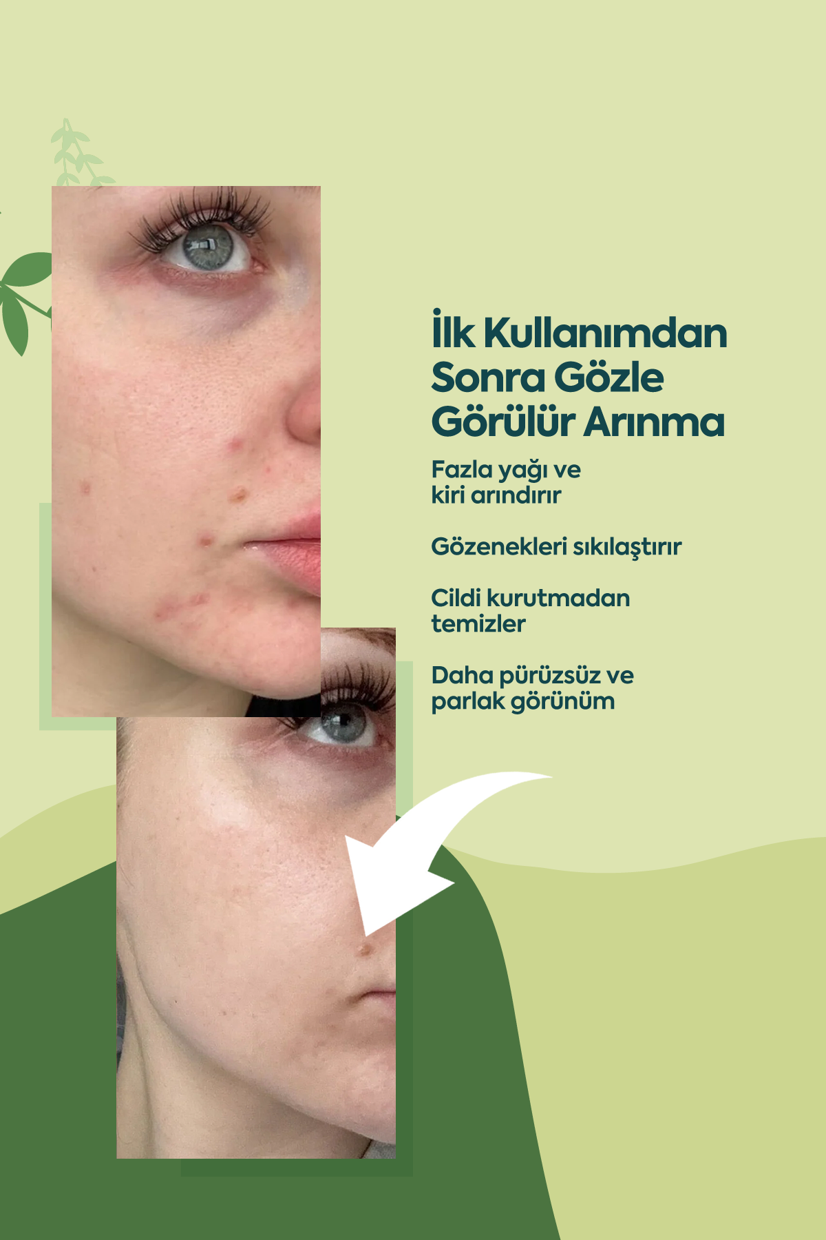 Ölü Deriye Karşı Kil Maskesi - 100 مل