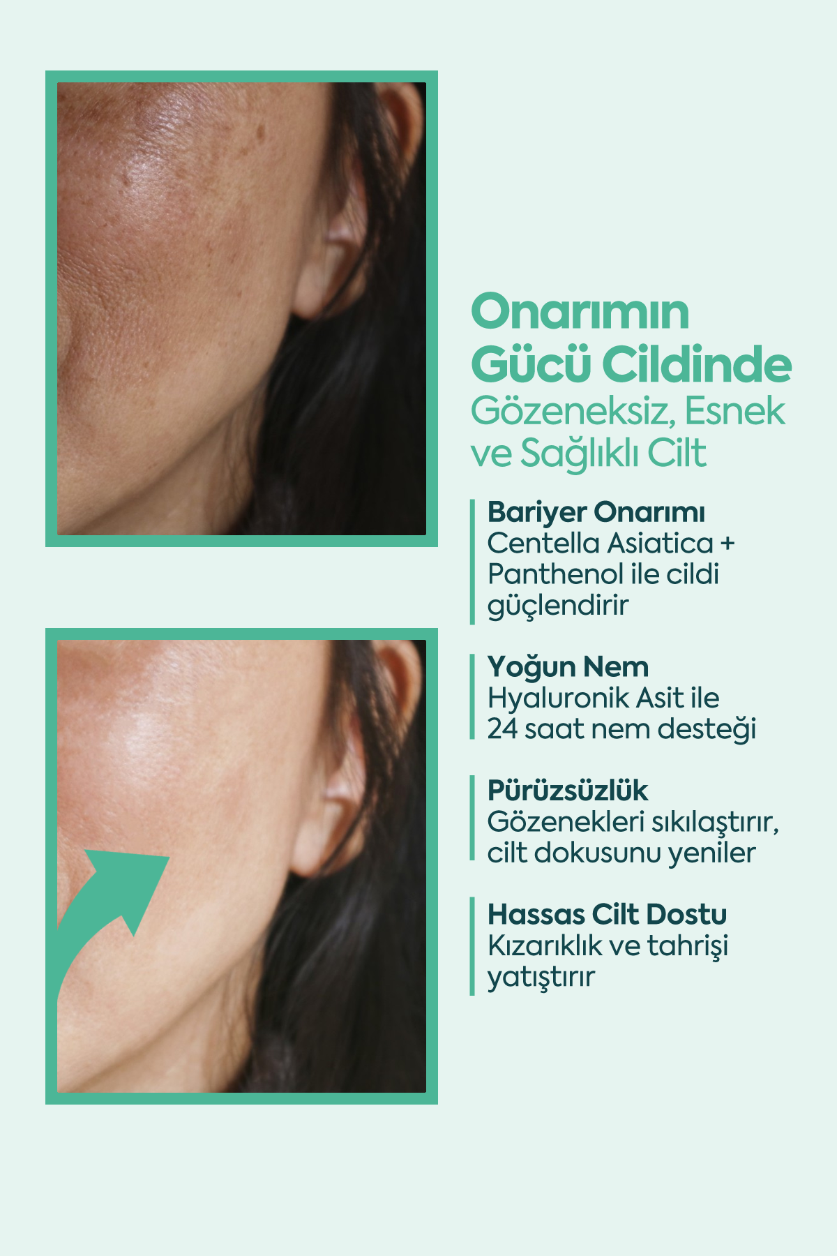 Mükemmel Cilt Onarıcı - كريم FACEUPSKIN® التصالحي 40 مل