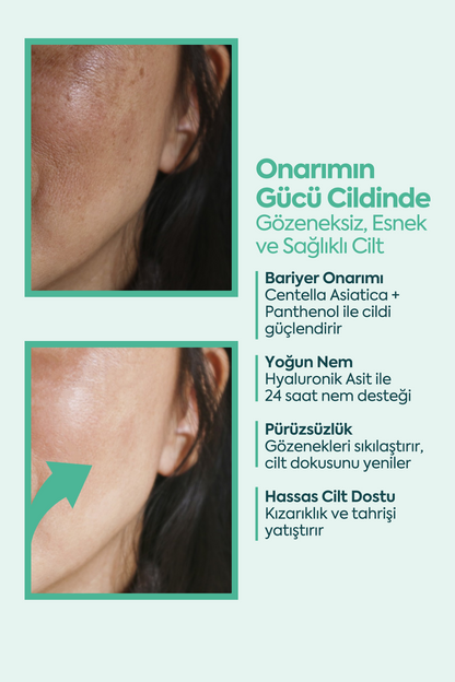 Mükemmel Cilt Onarıcı - كريم FACEUPSKIN® التصالحي 40 مل